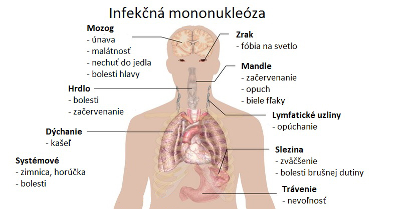 Jak vzniká mononukleóza?